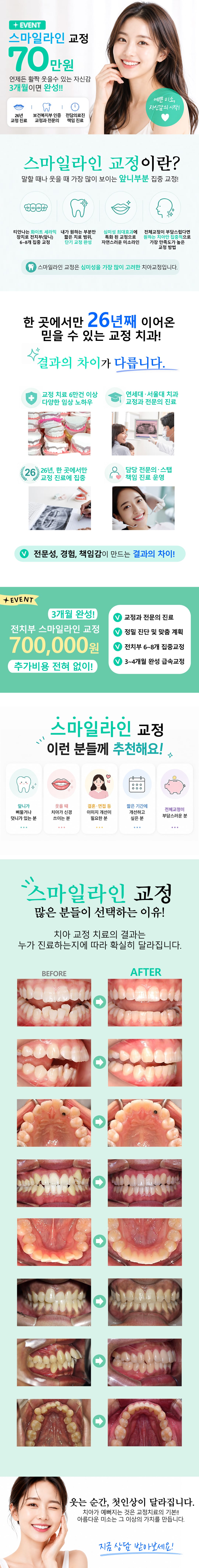 스마일라인 교정 70만원 이벤트